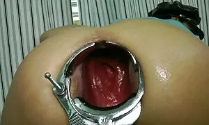 ስፔኩሉም ፕሮላፕስ ብናይ ማሚ መ ...